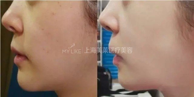 不做“女旱子”, <wbr>快做水光吧!