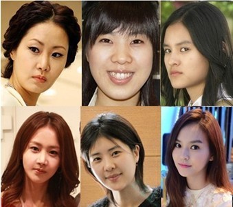 突嘴究竟需不需要做手术?